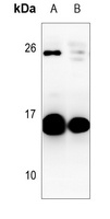 GM-CSF Antibody