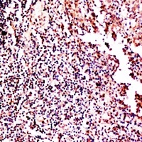 GM-CSF Antibody