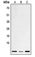 Defensin beta 1 Rabbit Polyclonal Antibody