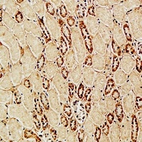 CD105 Rabbit Polyclonal Antibody