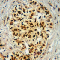 p300 (Phospho-S1834) Rabbit Polyclonal Antibody
