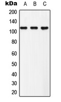 EPHB3 (Phospho-Y608) Rabbit Polyclonal Antibody