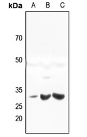 HLA-DQB2 Rabbit Polyclonal Antibody
