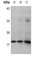 HMGA1 Rabbit Polyclonal Antibody