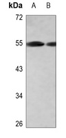 CD181 Rabbit Polyclonal Antibody