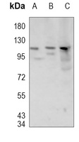 MLK3 (Phospho-T277/S281) Rabbit Polyclonal Antibody