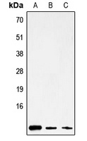 ATP8 Rabbit Polyclonal Antibody