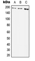 PDGFR beta (Phospho-Y1009) Rabbit Polyclonal Antibody