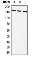 PLC gamma 2 (Phospho-Y759) Rabbit Polyclonal Antibody
