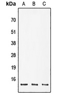 POLR2K Rabbit Polyclonal Antibody