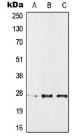 IPP1 Rabbit Polyclonal Antibody