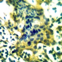 IPP1 Rabbit Polyclonal Antibody