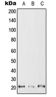 RAC2 Rabbit Polyclonal Antibody