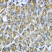 RAC2 Rabbit Polyclonal Antibody