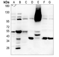 RBBP6 Rabbit Polyclonal Antibody