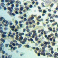 RBBP6 Rabbit Polyclonal Antibody