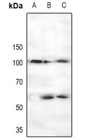 CTIP (Phospho-S327) Rabbit Polyclonal Antibody