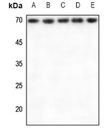 RPA1 Rabbit Polyclonal Antibody