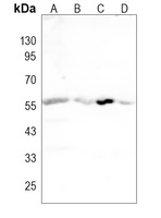 SSTR2 Rabbit Polyclonal Antibody