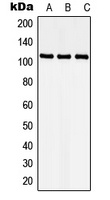 CDKL5 Rabbit Polyclonal Antibody
