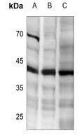 DR5 Antibody