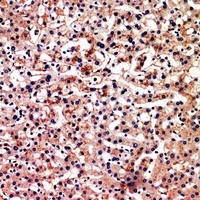 BAG3 Rabbit Polyclonal Antibody
