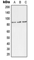 TLK1 (Phospho-S743) Rabbit Polyclonal Antibody