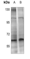 CHK2 (Phospho-T432) Rabbit Polyclonal Antibody