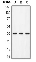 LAT (Phospho-Y255) Rabbit Polyclonal Antibody