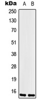 LSM1 Rabbit Polyclonal Antibody