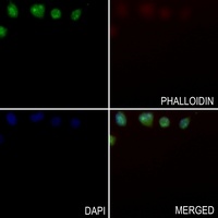 NIP7 Rabbit Polyclonal Antibody
