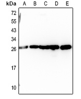 RAB14 Rabbit Polyclonal Antibody
