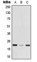MED29 Rabbit Polyclonal Antibody
