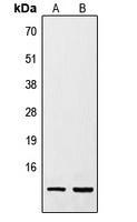 Resistin Rabbit Polyclonal Antibody