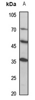 MINA53 Rabbit Polyclonal Antibody