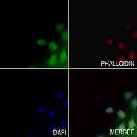 MINA53 Rabbit Polyclonal Antibody