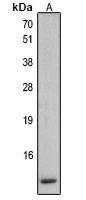 Defensin beta 2 Rabbit Polyclonal Antibody