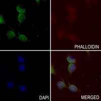 Defensin beta 2 Rabbit Polyclonal Antibody