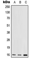 RPS17 Rabbit Polyclonal Antibody