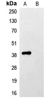 FLAG-tag Rabbit Polyclonal Antibody