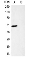 HA-tag Rabbit Polyclonal Antibody