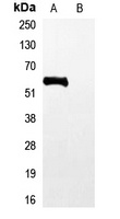 His-tag Rabbit Polyclonal Antibody