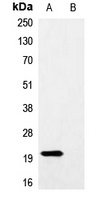 Myc-tag Rabbit Polyclonal Antibody
