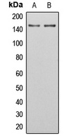 SGK223 (Phospho-Y413) Rabbit Polyclonal Antibody
