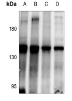 ABL1 Rabbit Polyclonal Antibody
