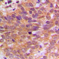 ABL1 Rabbit Polyclonal Antibody