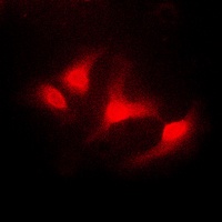 ABL1 Rabbit Polyclonal Antibody