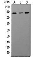 ADAR1 Rabbit Polyclonal Antibody