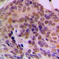 ADAR1 Rabbit Polyclonal Antibody