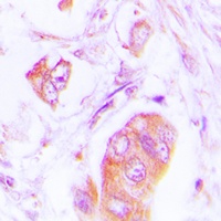 Alpha-adducin Rabbit Polyclonal Antibody